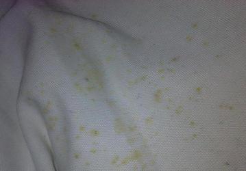 衣服有霉点怎么办？实用方法助你轻松去除霉斑