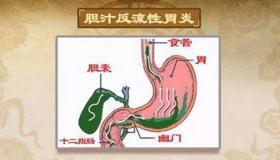 嗳气：消化道疾病的常见症状与含义